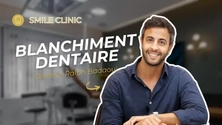 Blanchiment dentaire à la maison