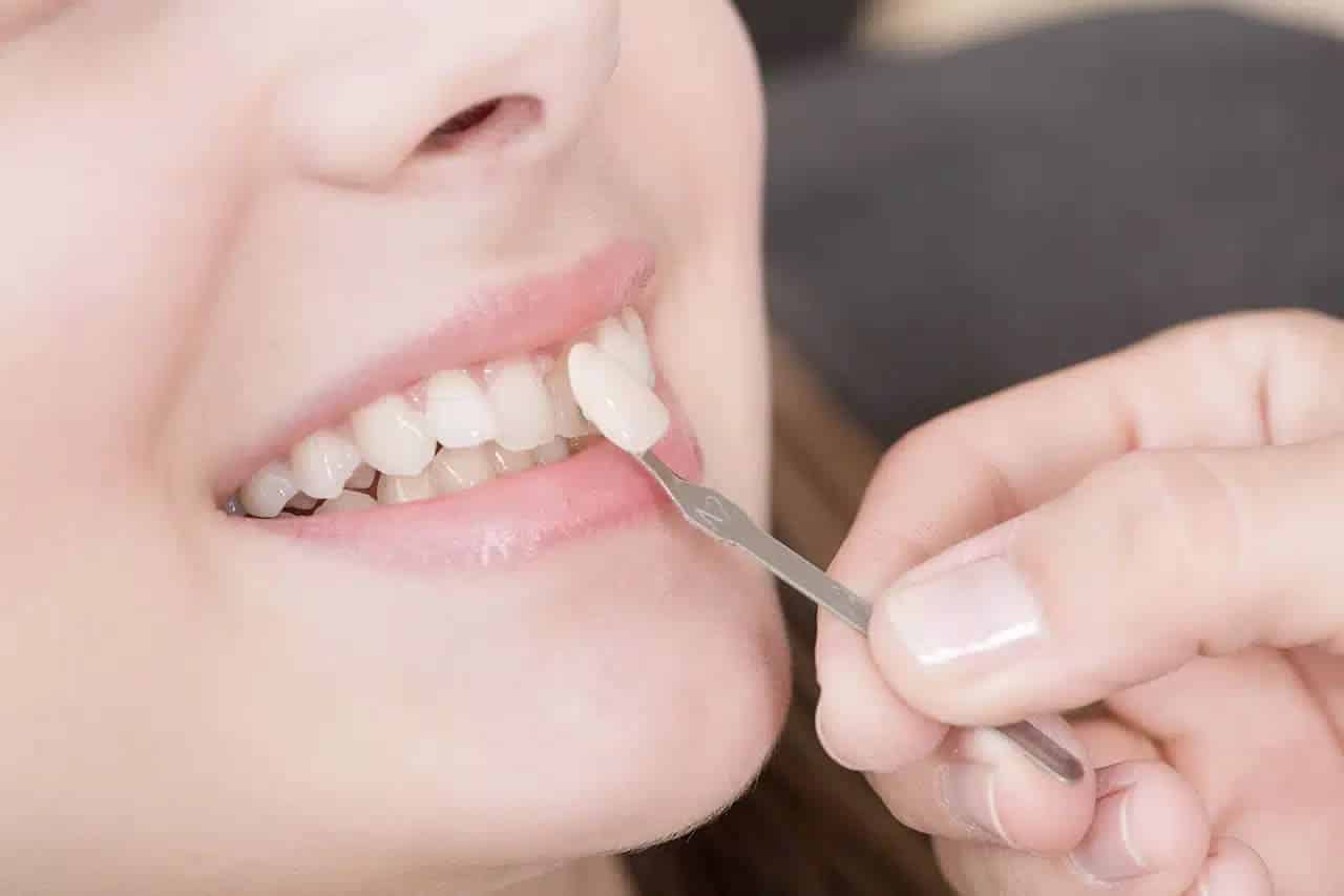 Dental polishing