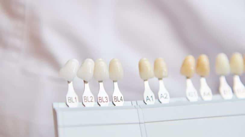 Regular dental visit