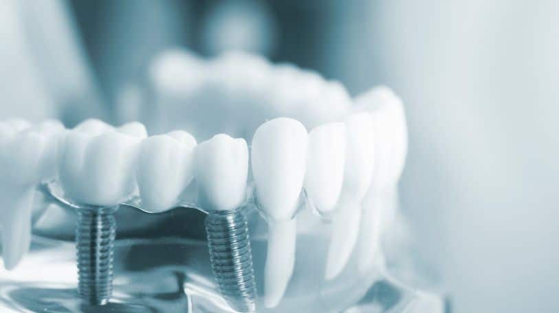 Whitening strips