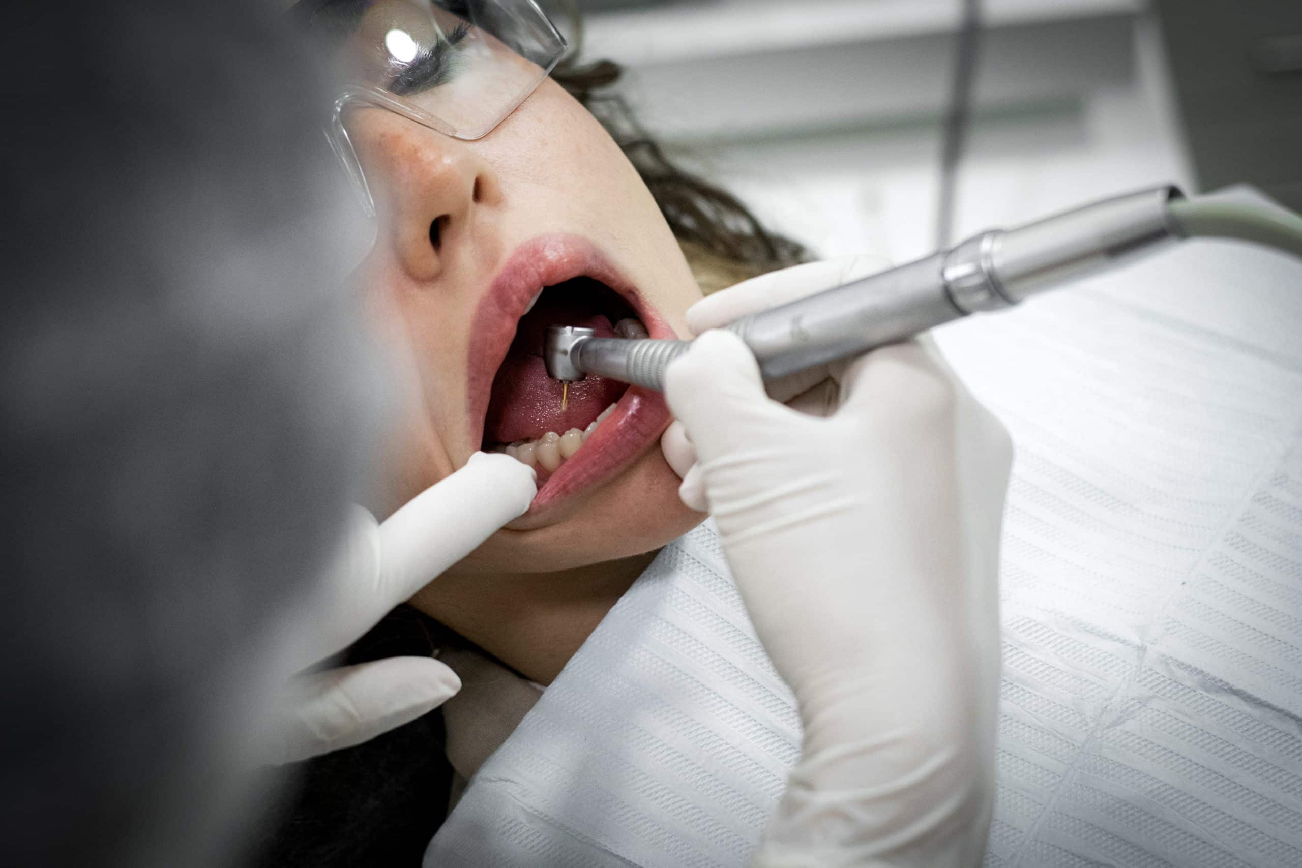 Surmonter la peur de l’anesthésie chez le dentiste