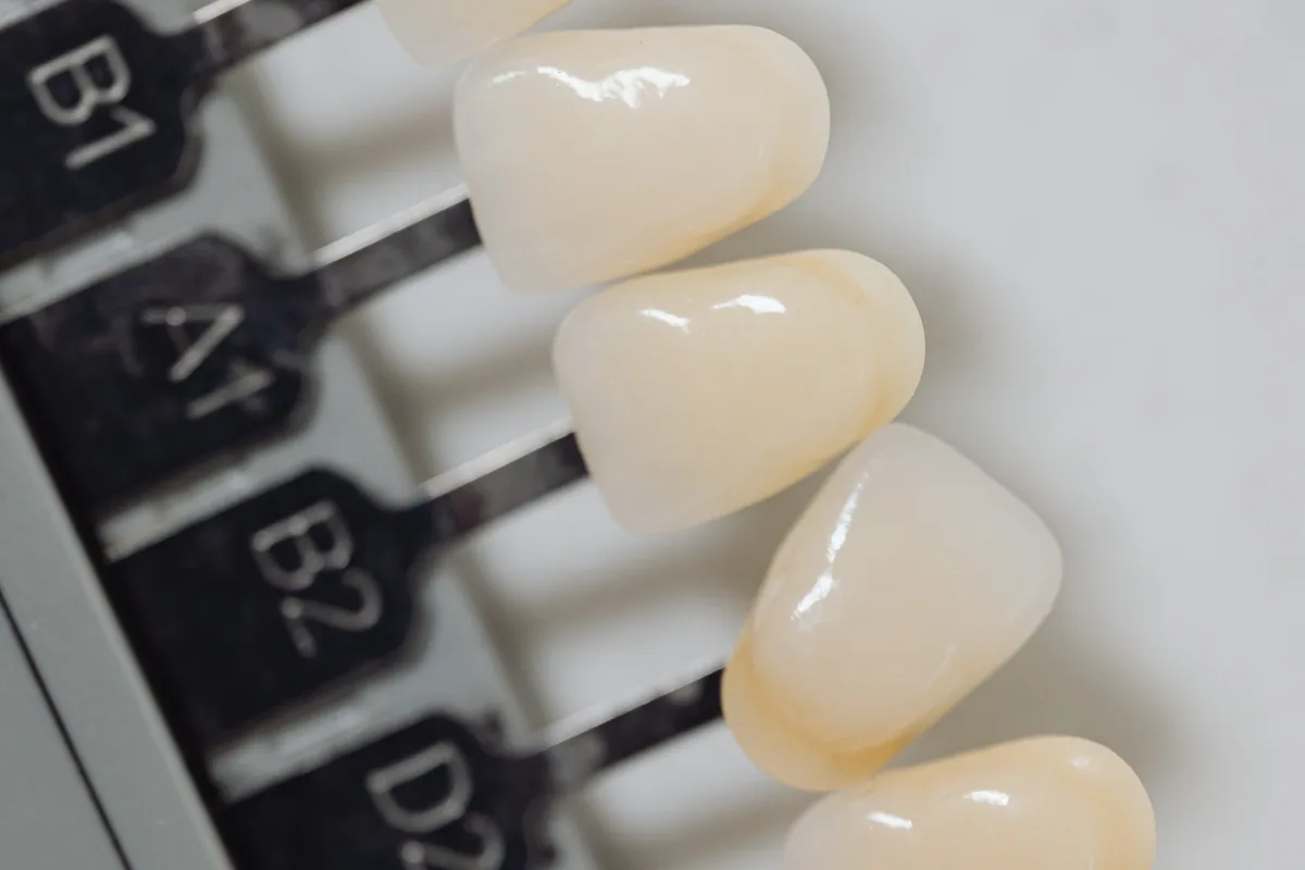 Caring for composite dental veneers