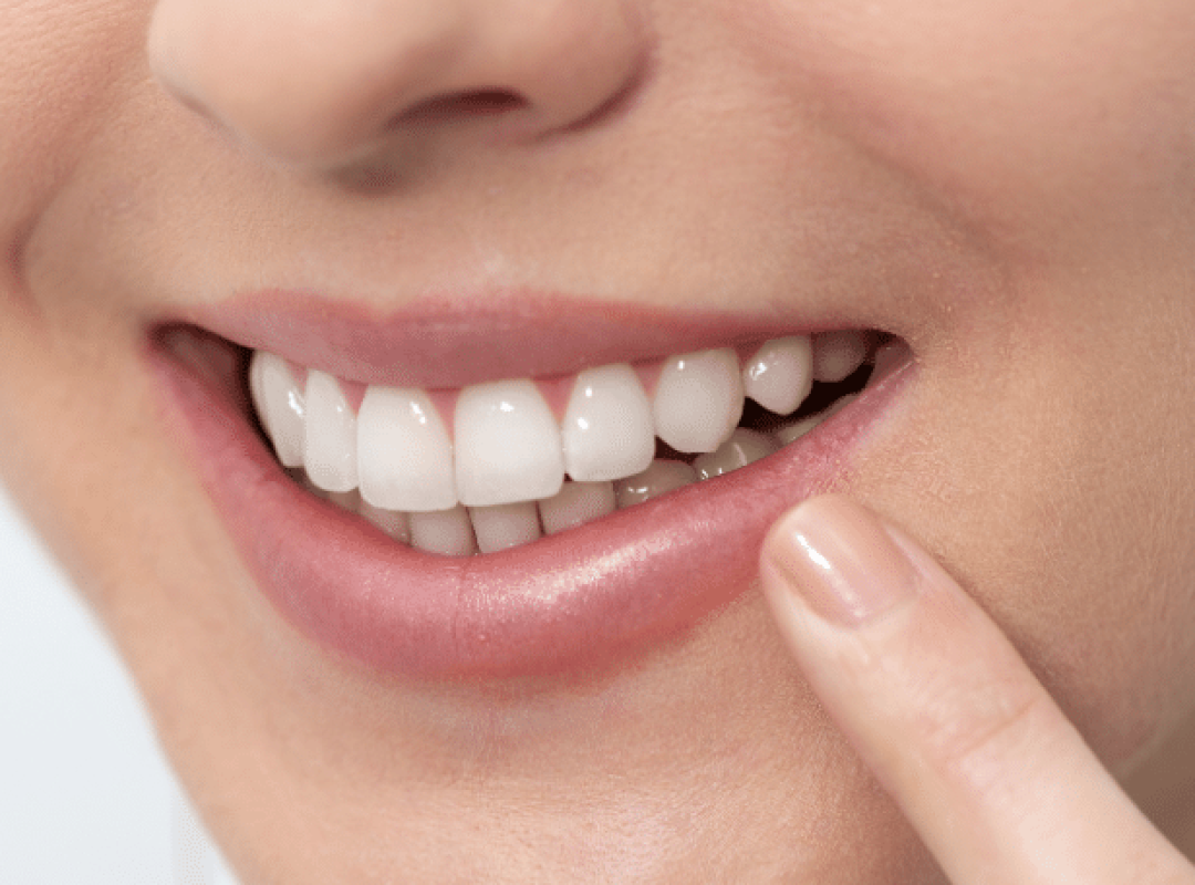 Advice after wisdom teeth extraction