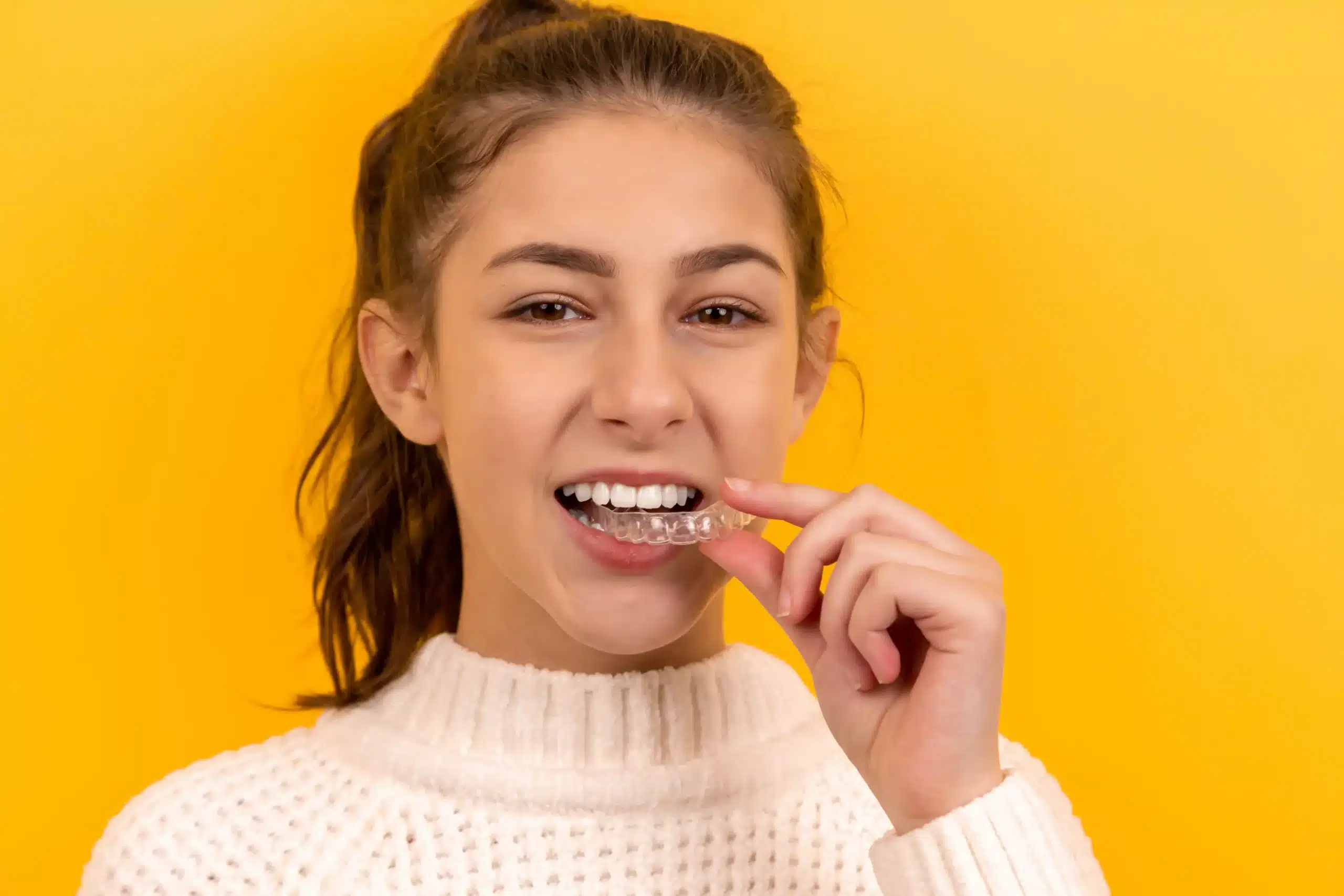 Gouttière orthodontique transparente Invisalign