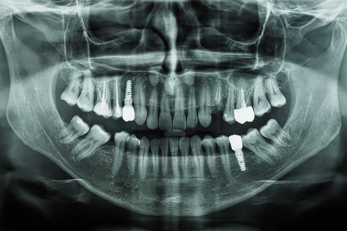 Diagnostic et imagerie dentaire de précision