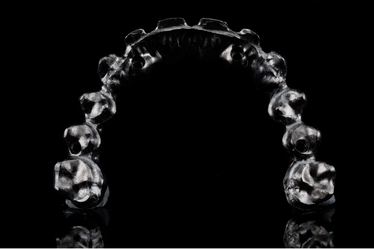 Bilan occlusal au Cabinet Dentaire de la Madeleine