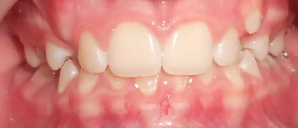 Consultation pour un traitement orthodontique personnalisé