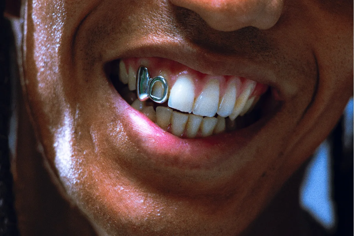 Choosing a tooth gem