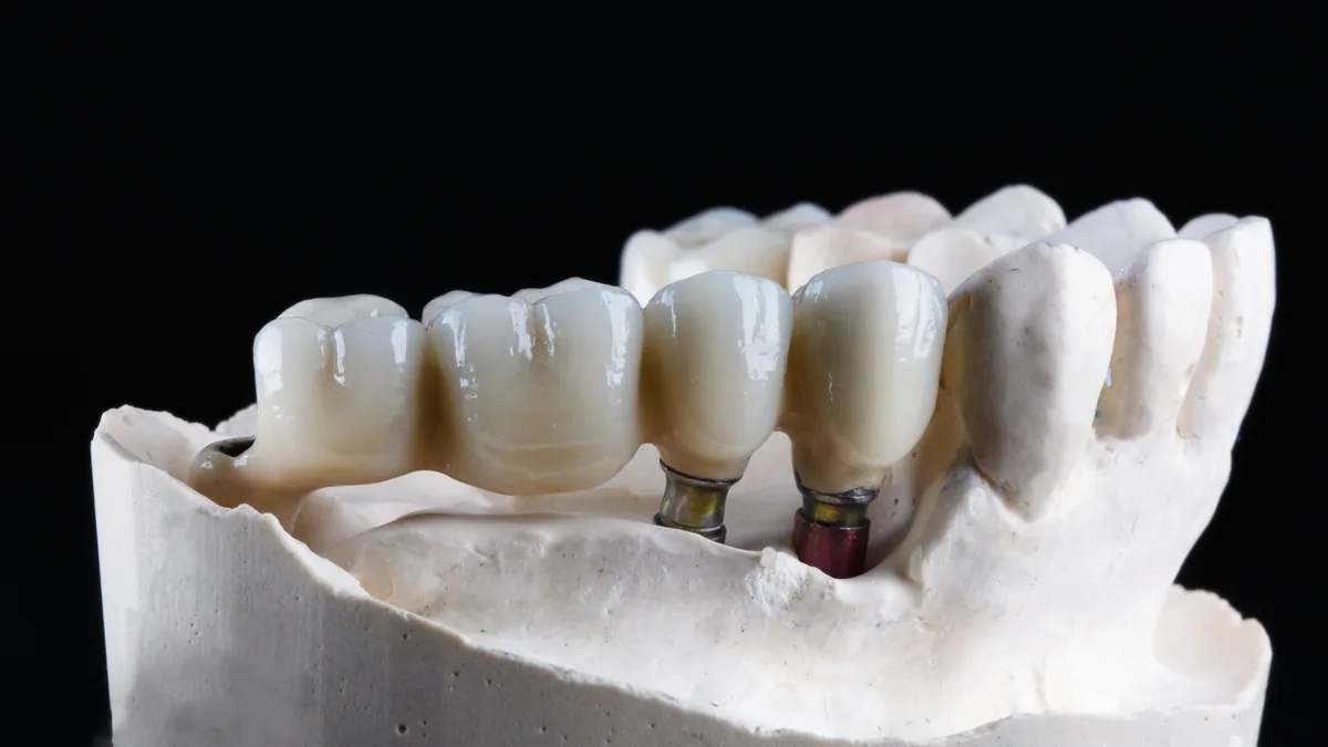 Traitement par implants dentaires