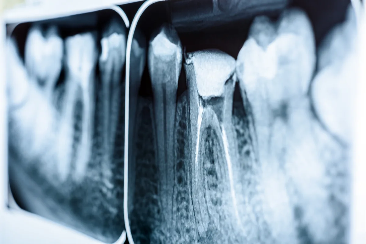 Endodontie
