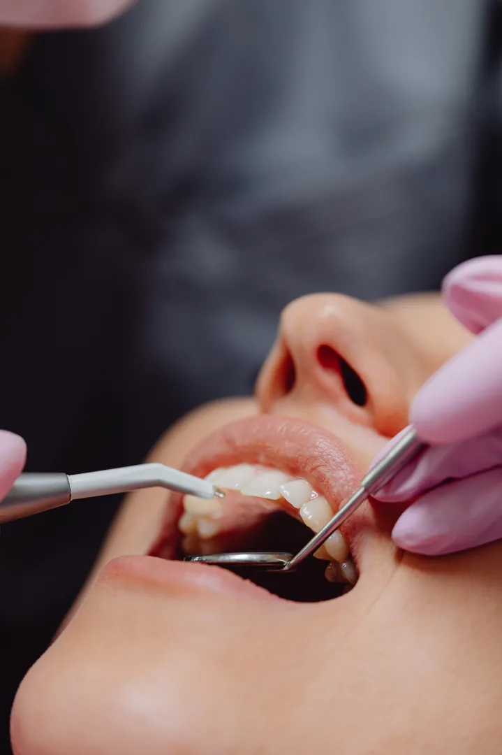 Examen d’une dent pouvant présenter une infection autour de la racine
